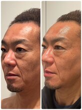 ビーアンドアイ シズオカテン レディース(B＆I SHIZUOKA)/2回目のお客様