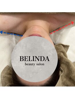 ベリンダ 中崎町店(BELINDA)/【筋膜リリース】華奢に♪