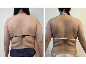 ペルナ(perna)/温リンパ/痩身エステ