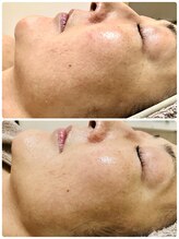 ムク(MUKU 無垢)/セラピール