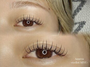 アニュレア バイ レヴィエリス(Anurea by Re’VIELISS)/フラットラッシュ140本