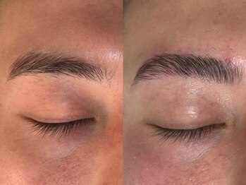 total beauty Allieの写真/【男女OK】一部位から選べるメニューあり!全メニュー都度払いで、お手軽にトータルビューティーが叶う♪