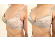 キューティ(Cutie)の雰囲気(産後バスト、放置はもったいない!美しく整えるケア始めましょ☆)