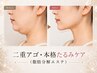 【フェイシャル】本格たるみケア/二重あご集中◎《脂肪分解エステ》￥15400→