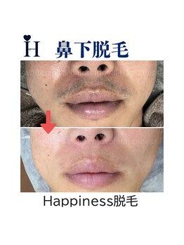 ハピネス 心斎橋アメリカ村本店(Happiness)/
