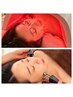 【新規人気No1】SPECIAL美容鍼75分｜小顔＋EMS＋LED＋肌管理 ￥12,000→￥9,800