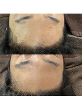 リュウ(le.lieu)/1ヶ月の変化