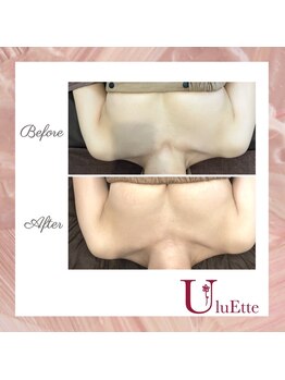 ウルエッテ(UluEtte)/どんどん育つバスト/福岡バスト