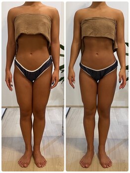 ハッチー(Hacchi)/【20代】むくみ撃退！