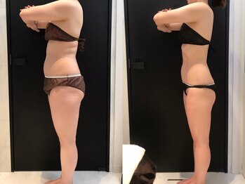 リボディ 表参道(An re Body)の写真/オーナー自身がこのプログラムで痩せてリバウンドもなし!結果が出ているからこそ遠方から通うお客様も多数!