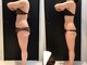 リボディ 表参道(An re Body)の写真/オーナー自身がこのプログラムで痩せてリバウンドもなし!結果が出ているからこそ遠方から通うお客様も多数!