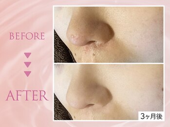 クリアラボ 川崎(Clear Lab)/韓国肌管理&毛穴洗浄専門店