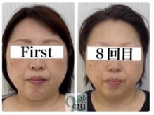 キュープ 名張店(Qpu)/オイルコース８回での変化