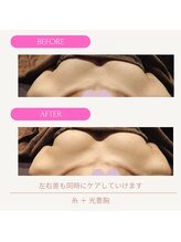 ムーンライズ(moonrise)/