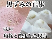 ニュートラル(neutral)の雰囲気（汚れを拡大！正体はこちら↑いらない汚れは取りましょう！）