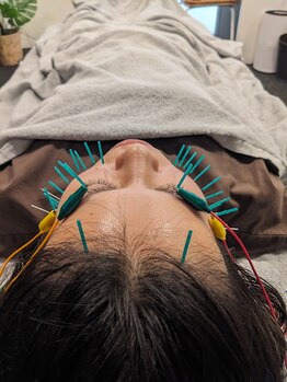 乃々鍼灸整体院 表参道/美容鍼