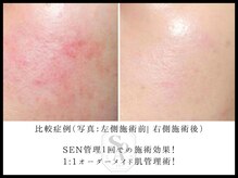 韓国肌管理室 ソア(soa)/【たった一回SEN管理】