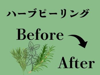 ビースキン 広島(BE:SKIN)/ハーブピーリング/ニキビケア