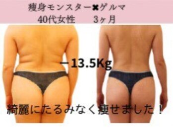 ファニービー 茨木本店/Before→After