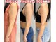 サロンノコ(salon NOKO)の写真/【効果抜群◎】<ドレス映えするボディに>韓国で人気の美容液レッドショット導入店◎ダイエット/痩身
