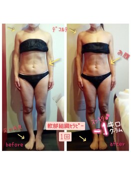ビューティサロン キヨの部屋(beauty salon)/【軟部組織セラピー】 １回 