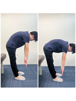 パシオン接骨院 整体院/ビフォーアフター