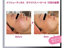 オレンジバナナ 県央店/【ホワイトスノーピール】