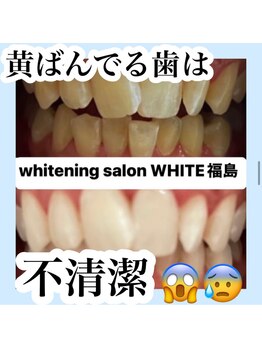 ホワイトニングサロン ホワイト(WHITE)/セルフホワイトニング/大阪/福島