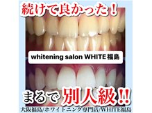 ホワイトニングサロン ホワイト(WHITE)/セルフホワイトニング/大阪/福島