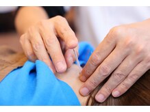 りゅうた整骨院 鍼灸院 宝塚中山寺店/鍼灸