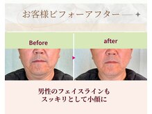 プランドール/男性もシュっとした小顔に♪