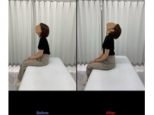 整体リアン 天神院(Lien)/ビフォーアフター：首の可動域