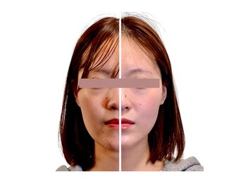 東麻布アマン(東麻布Aman)/befor / after