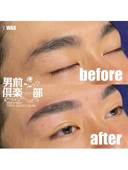 男前倶楽部/脱毛/メンズ脱毛/メンズ専門店