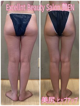 エクセレントビューティーサロン 艶(EN)の写真/悩める筋肉の張り・凸凹セル脂肪・浮腫みにアプローチ！VENUSDIVA＋EMS/パルス磁場を使用！美尻美脚へ