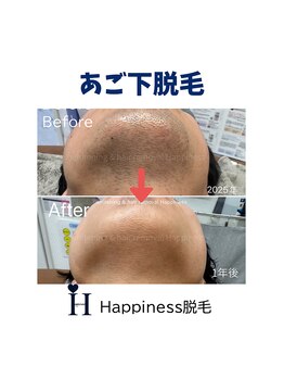 ハピネス 心斎橋アメリカ村本店(Happiness)/
