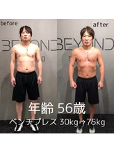 ビヨンド 札幌大通店(BEYOND)/男性 ビフォーアフター
