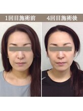 シェア 人形町店(Chare)/【小顔・骨盤矯正・О脚・整体】