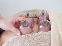 ヒトハリ 福岡薬院店(HITOHARI)/カッピング