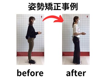 ほねつぎ 平成けやき通り鍼灸接骨院/骨盤矯正ビフォーアフター5