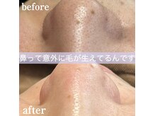 ブリリアント(brilliant)/フェイシャルワックス