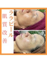 トータルビューティーサロン ヴィヴィエ(ViVier)/ララピール