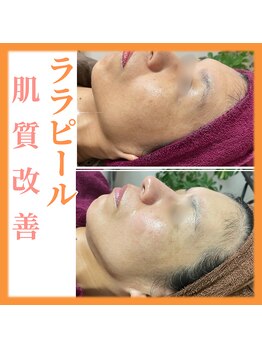 トータルビューティーサロン ヴィヴィエ(ViVier)/ララピール