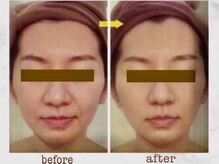 ナチュラーレ 京都四条烏丸店(Naturale)/美肌ニキビケア小顔フェイシャル