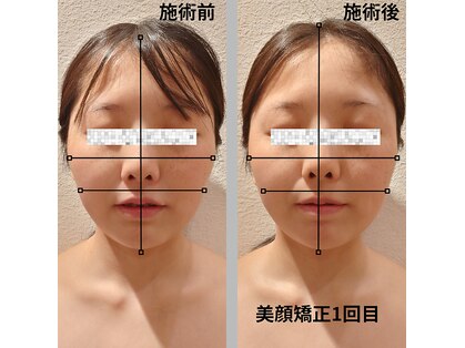 カモン(KAMON)の写真