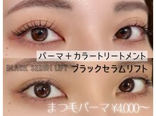 負担をかけないを最重視。当店ではマツパも内部補修ができる！