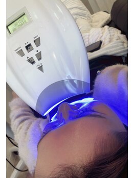 エクリュ(Ecru)/寝ている間に歯が白く★一石二鳥