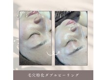 プレジール(Plaisir)