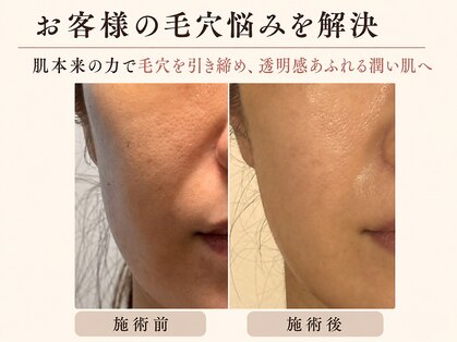 リアン(Lian)の写真