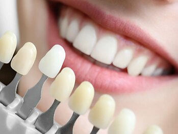 シロ(SHIRO)の写真/【セルフホワイトニングで自然な歯の白さを実現】気になる歯の黄ばみを解消◎明るく清潔感のある印象に♪